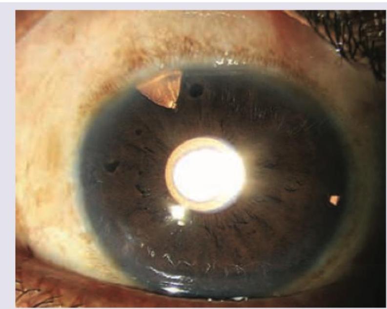 Image for question 91