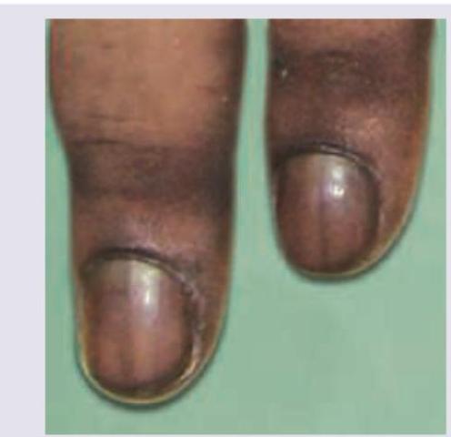 Image for question 70