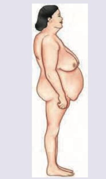 Image for question 1316