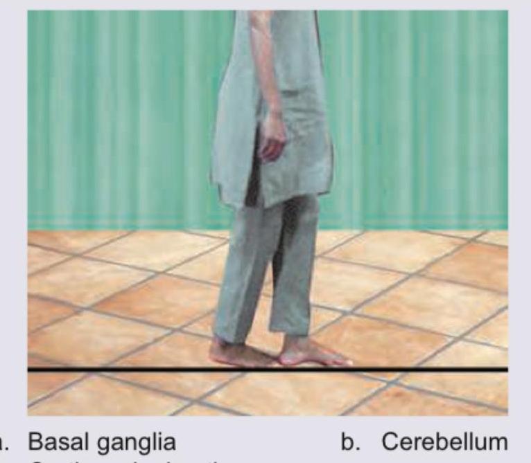 Image for question 72