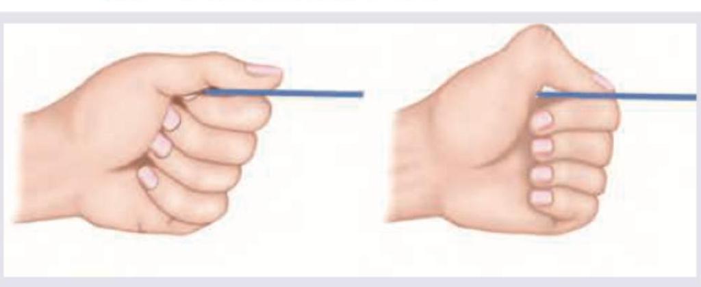 Image for question 73