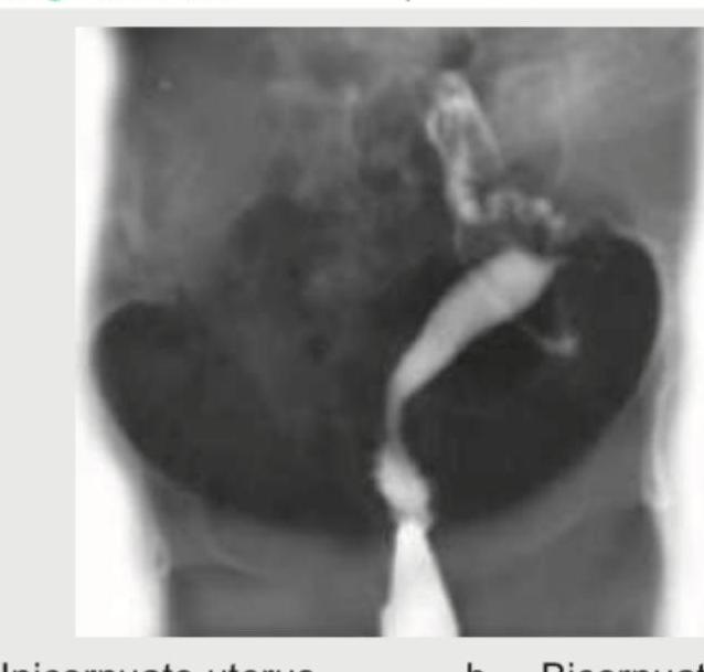 Image for question 180