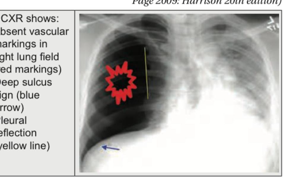 Image for question 365