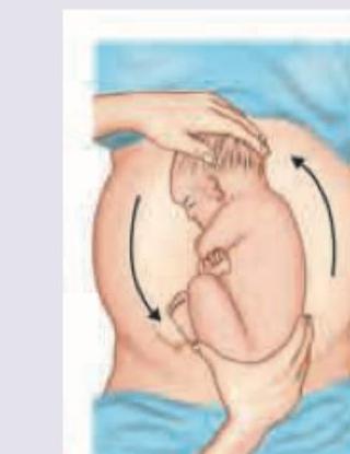 Image for question 202