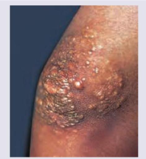 Image for question 252