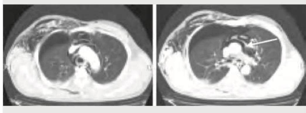 Image for question 390