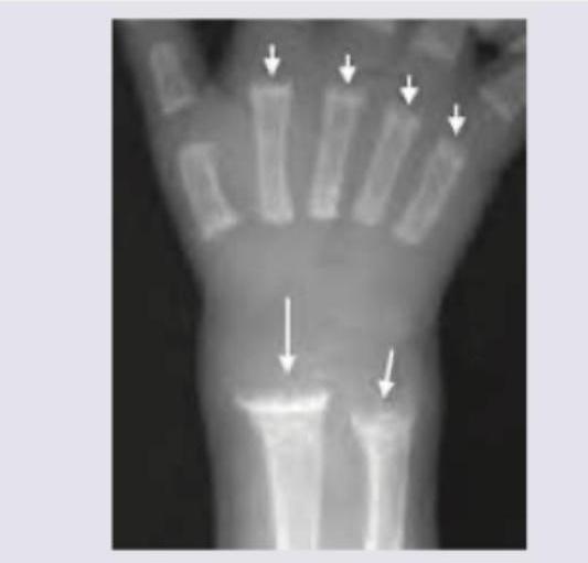 Image for question 361