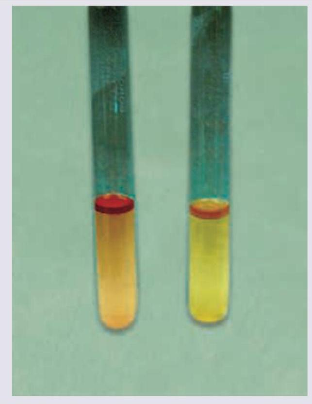 Image for question 172