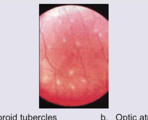 Image for question 399
