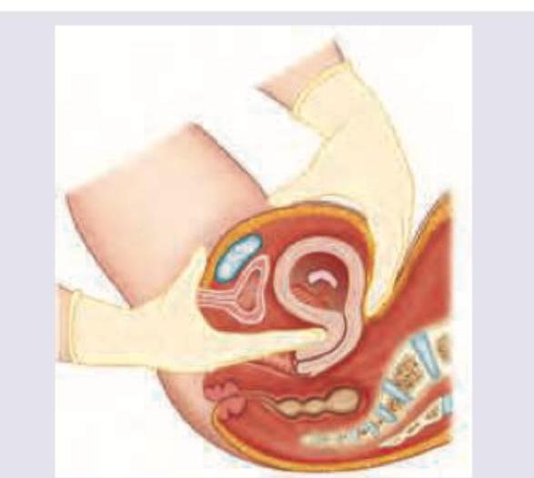 Image for question 474