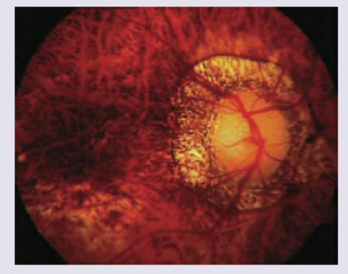 Image for question 249