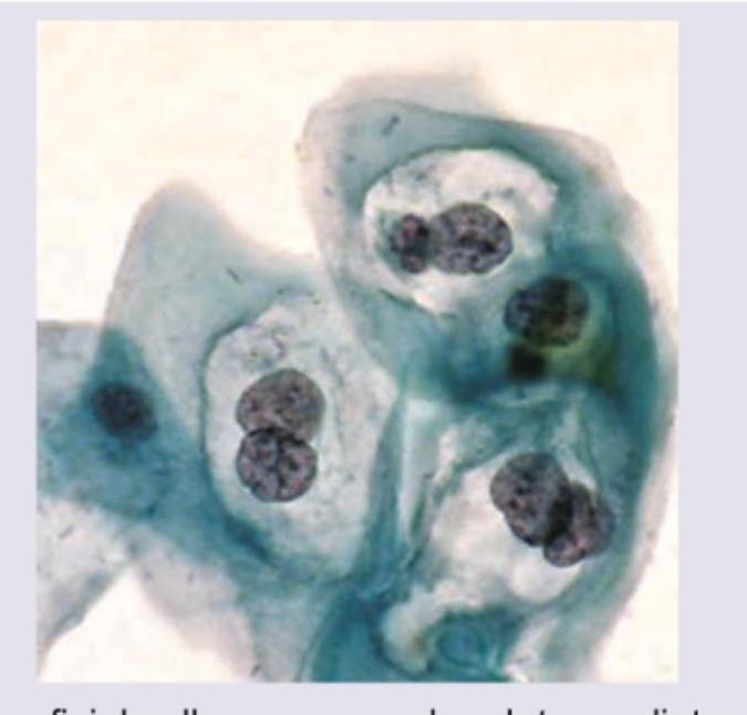 Image for question 115