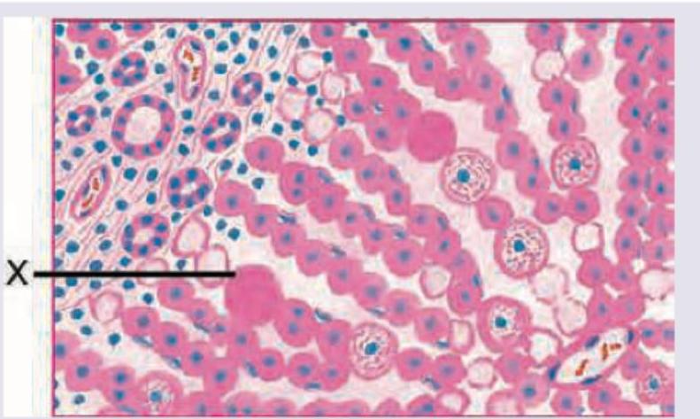 Image for question 352