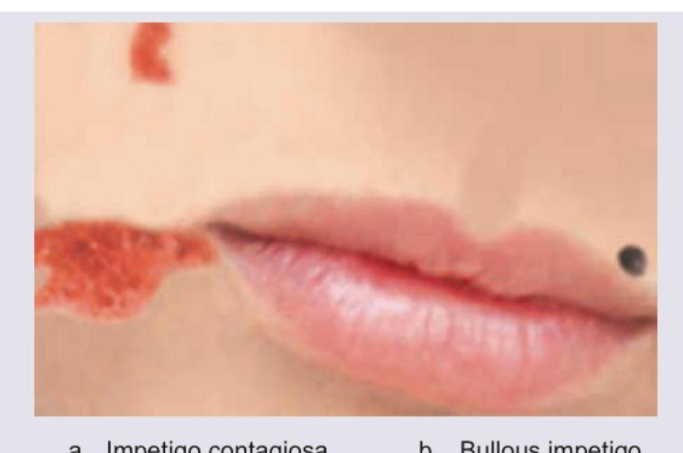 Image for question 176