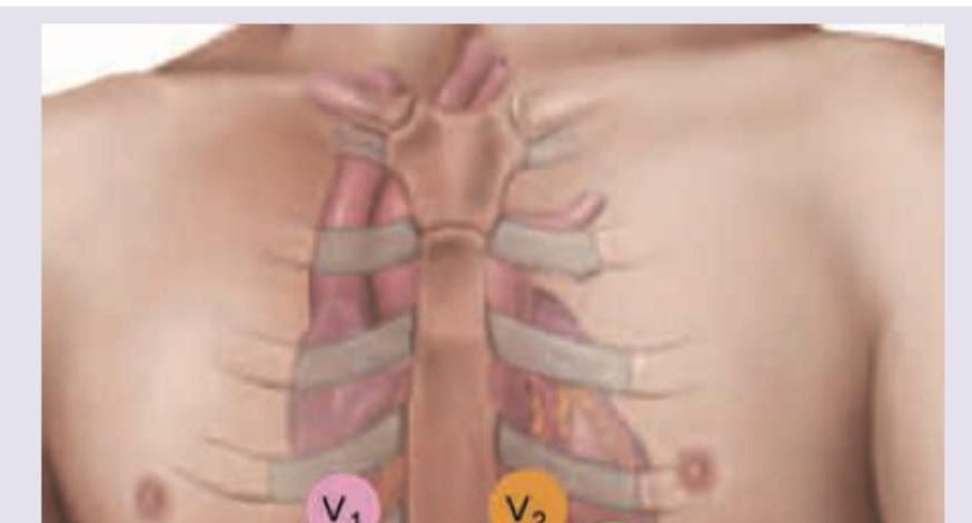 Image for question 9