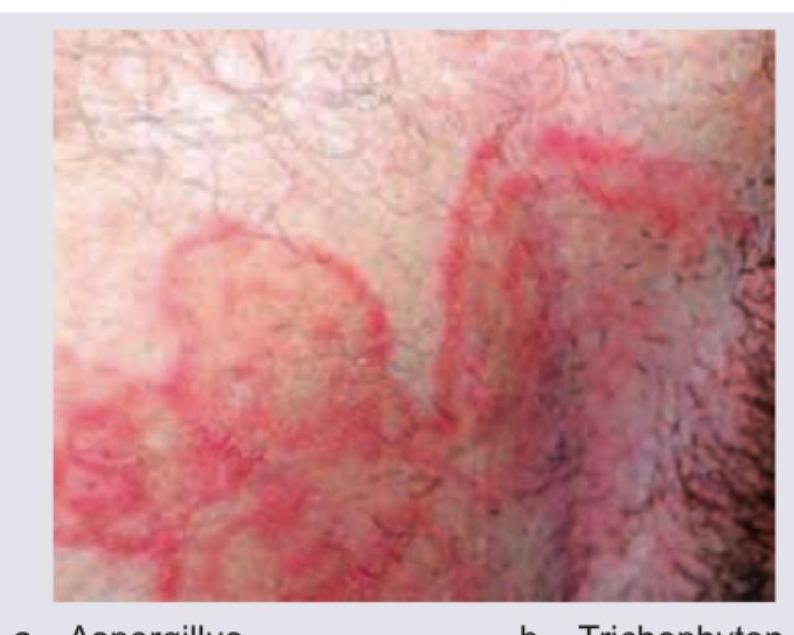 Image for question 111