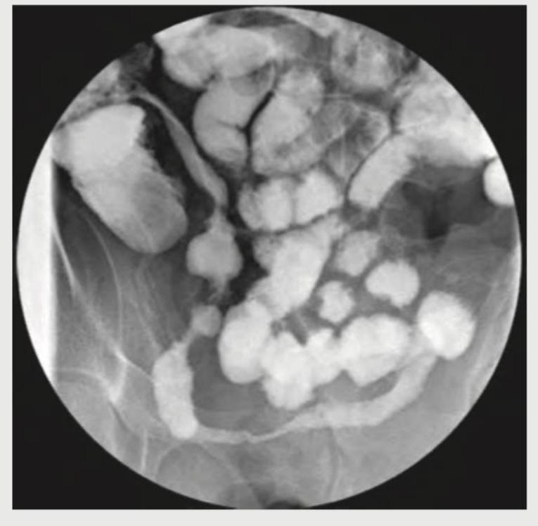 Image for question 140