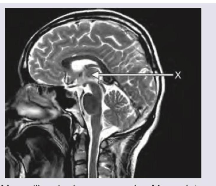 Image for question 66