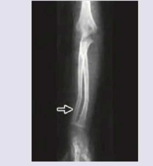 Image for question 277