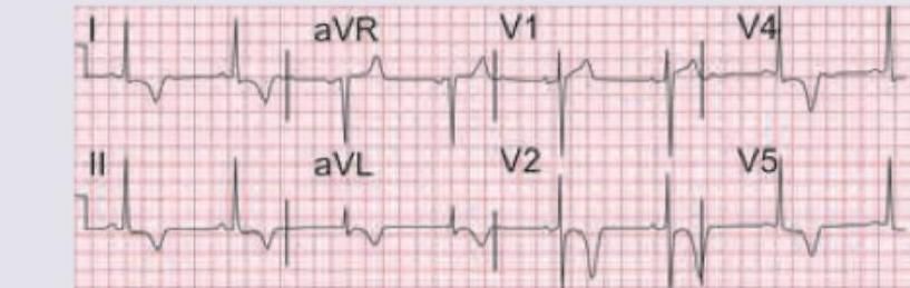 Image for question 62