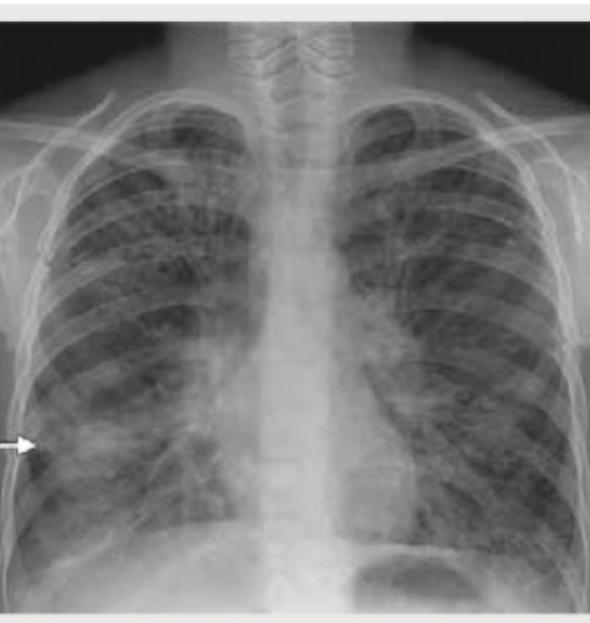 Image for question 403