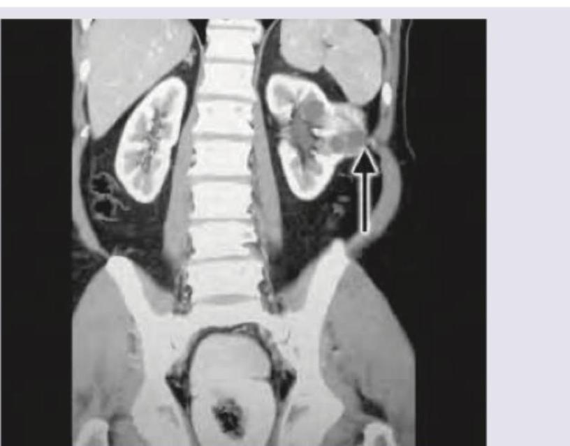 Image for question 534