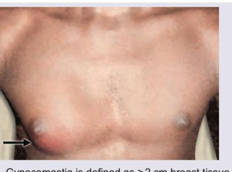 Image for question 828