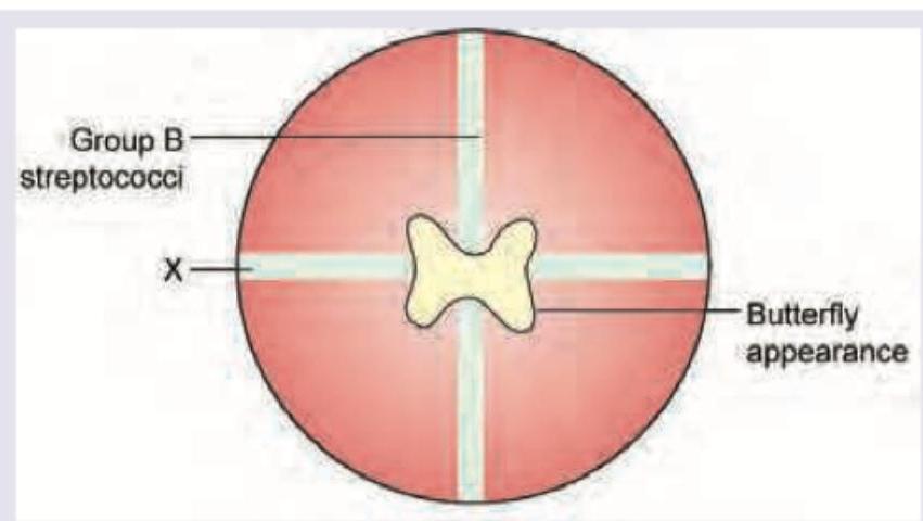 Image for question 10