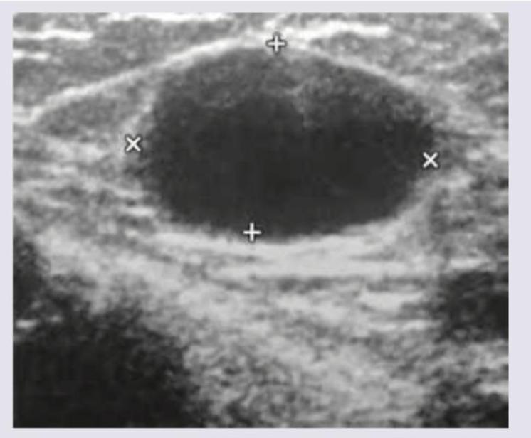 Image for question 273