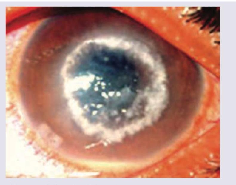 Image for question 332