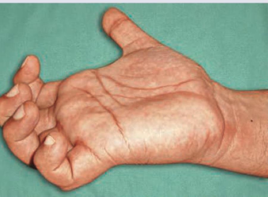 Image for question 205