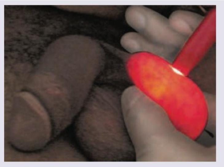 Image for question 933