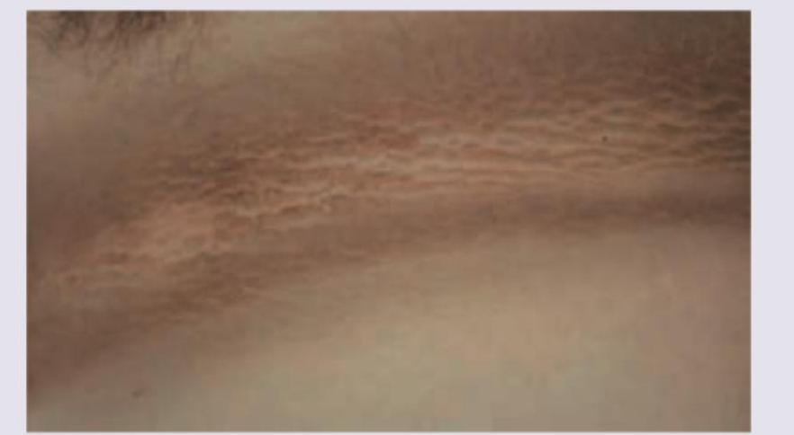 Image for question 215