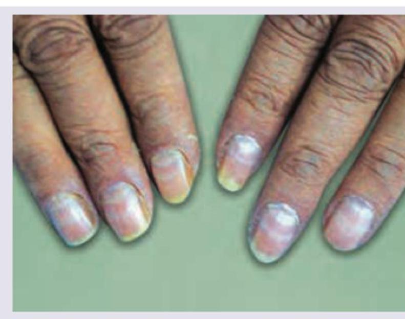 Image for question 58