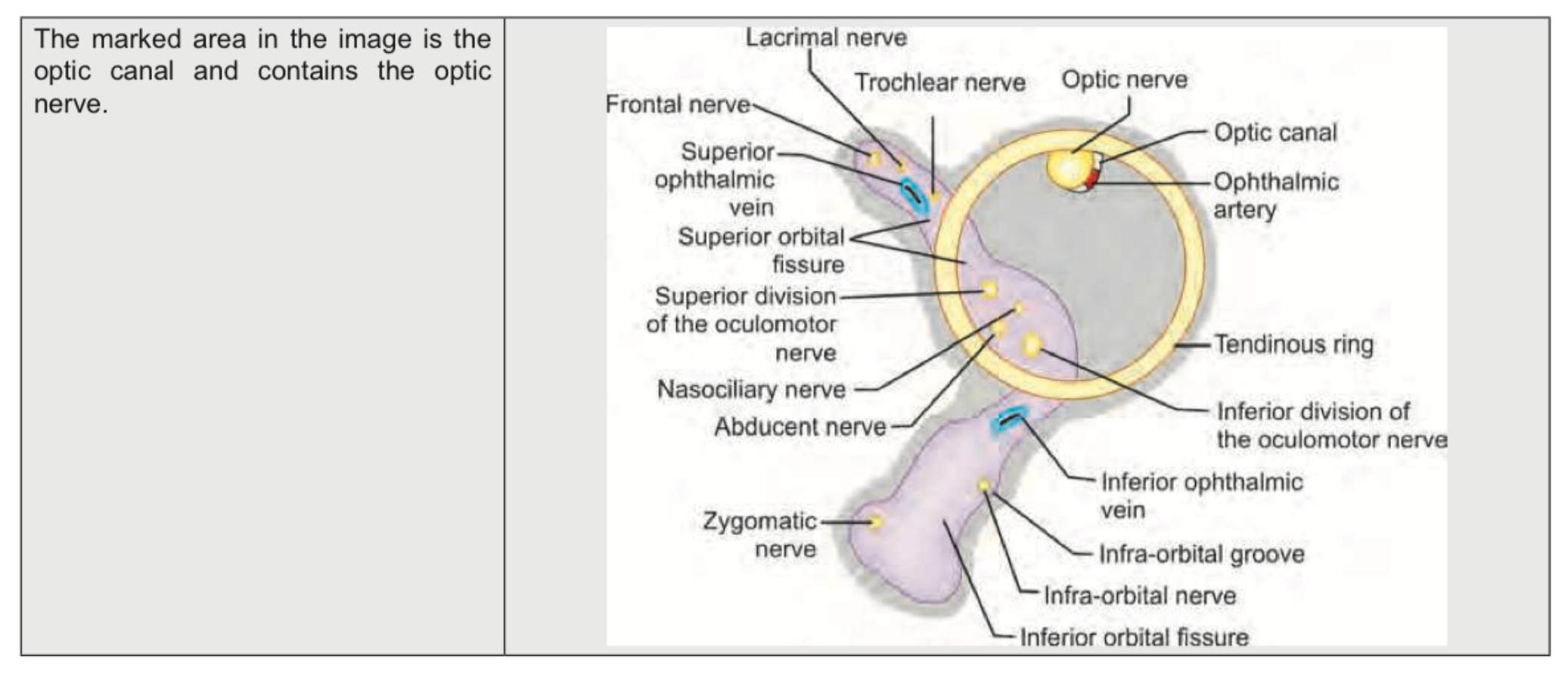 Image for question 1150