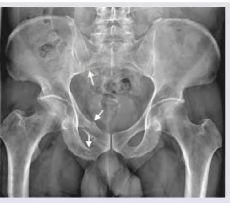 Image for question 911