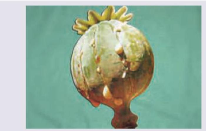 Image for question 647