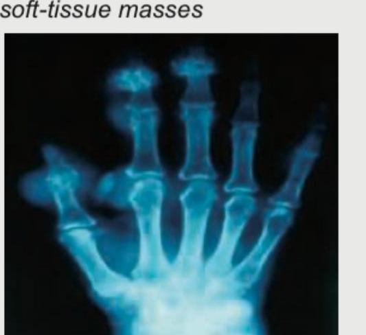 Image for question 616