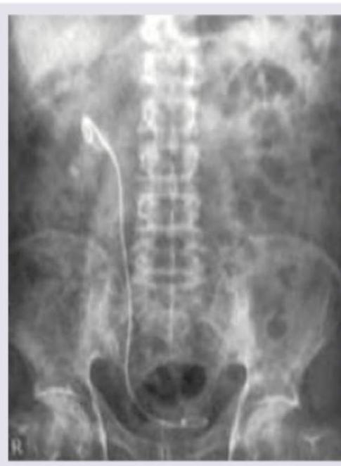 Image for question 938