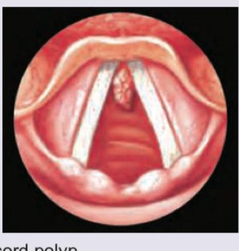 Image for question 201