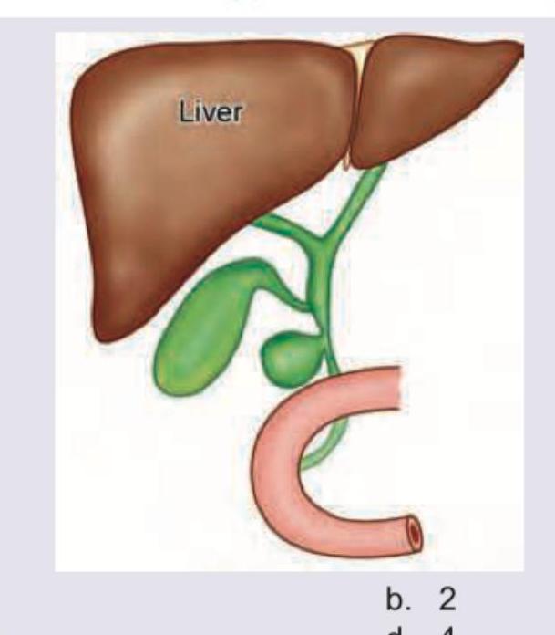 Image for question 493