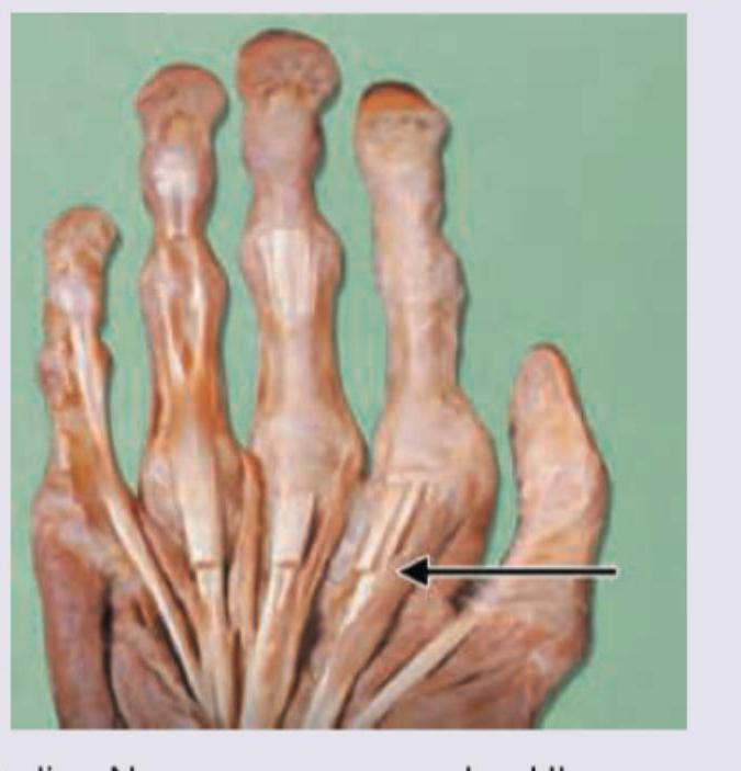 Image for question 294