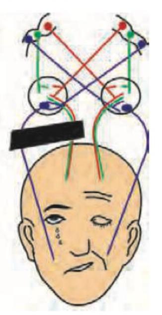 Image for question 37