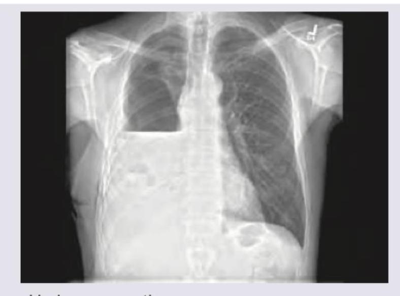 Image for question 371