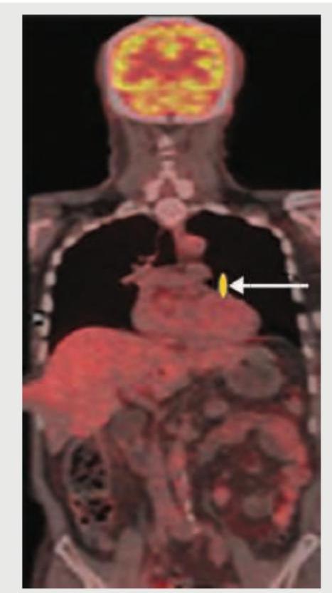 Image for question 165