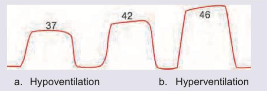 Image for question 289