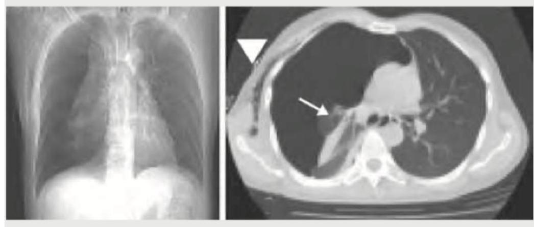 Image for question 9