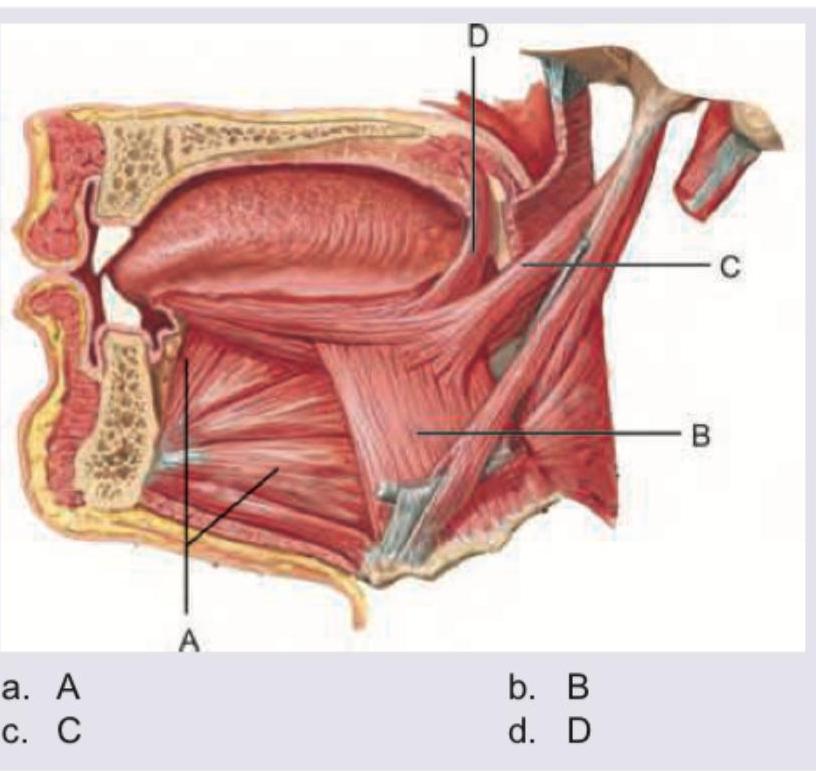Image for question 1159