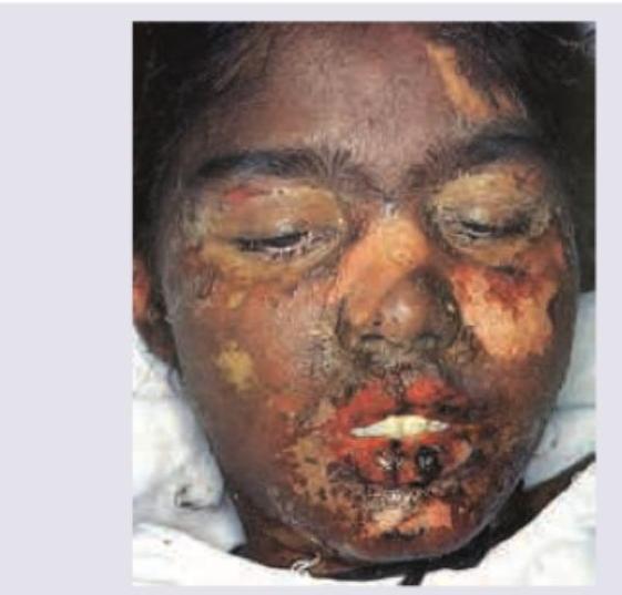 Image for question 261