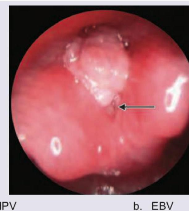 Image for question 199